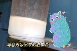 体验后-维秘形体医美 M·VVON医生集团