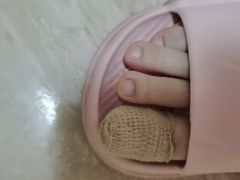 -世龙世家甲沟炎·灰指甲·嵌甲矫正·修脚(武侯区双楠店)