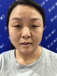 -郡艺医疗美容·微整·眼鼻吸脂