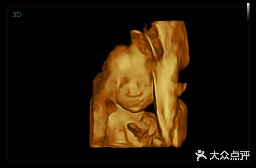 初见四维彩超摄影图片-北京孕妇写真-大众点评网