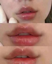 -上海漾颜医疗美容