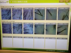 点击看大图 -LESSMORE科技头皮理容中心