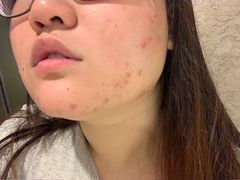 -上海市皮肤病医院(武夷路院区)