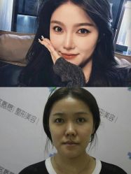 体验后-成都西区医院整形美容