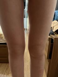 -洁铭新加坡医美