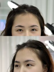 点击看大图 -张小野·专业半永久纹眉