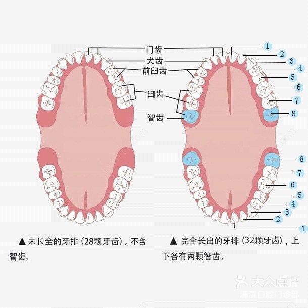 上牙智齿位置图图片