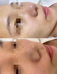 -春田皮肤管理中心品牌旗舰店