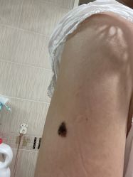点击看大图 体验前-八大处整形