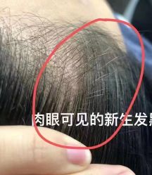 点击看大图 -侗秀养发•头疗