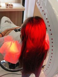 -大麦微针植发丨全国连锁