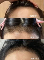 -雍禾植发全国连锁