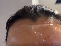 -安徽合肥韩美整形外科医院