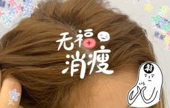 -大麦微针植发全国连锁