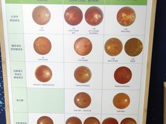 店内环境-宝岛眼镜(福州宝龙二店)