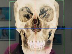 -Dr.Z dental仁康种植矫正中心