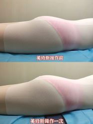 -摩瘦纤体订制减肥