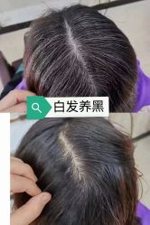 -诗碧曼养发