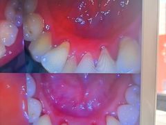 -圣贝口腔(海淀店)