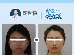 -柏乐口腔(南宁总院)