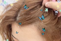 -大麦微针植发全国连锁