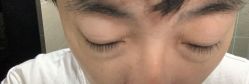 体验前-坤如玛丽·医疗美容中心