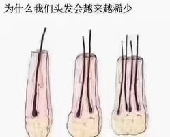 -诗碧曼养发