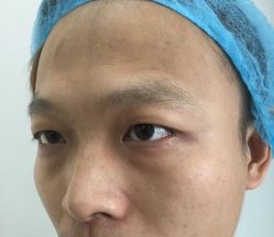 -天津健丽·去眼袋医疗美容机构