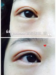 -YooMee优美智能科技美肤机构