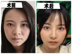 -素美医疗美容·西南眼鼻整形·修复基地