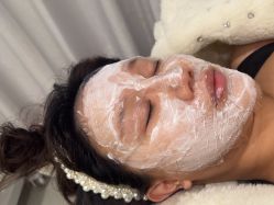 体验前-海涛医疗美容·面部抗衰·注射美鼻