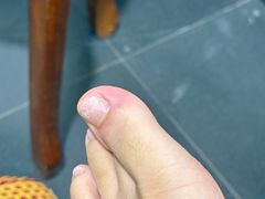 -郑远元专业修脚房·按摩·肉刺·灰指甲(苏绣路店)