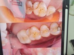 -牙博士口腔品牌连锁(杨浦店)