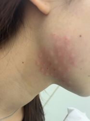 体验后-杭州奥拉克医疗美容门诊部
