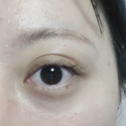 体验前-Yestar艺星医疗美容医院