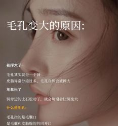 -闺蜜美甲