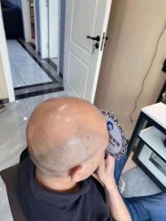 -唐风采假发补发定制