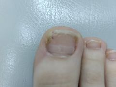 -新甲连锁灰指甲·甲沟炎·鸡眼(黑龙江路店)