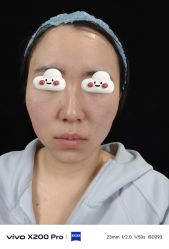 -深圳米兰柏羽医疗美容医院