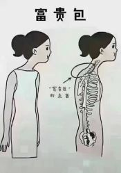 -香薇妮丝女子减肥院