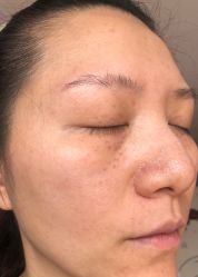 体验后-上海锦妍医疗美容门诊部