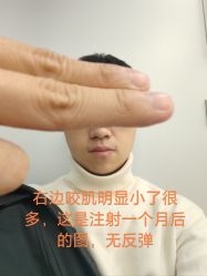 体验后-清华大学玉泉医院-医疗美容科