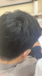 -菩叶脱发白发中心