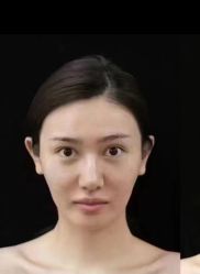 -郡艺医疗美容·微整·眼鼻吸脂