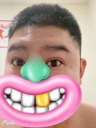 -More摩尔医美の注射线雕光电中心
