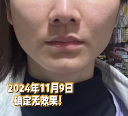 体验后-深圳阳光医疗美容医院·旗舰店