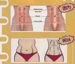 -涌泉妈咪树通乳·产后恢复