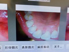 -团圆口腔·种植中心(锦江院区)
