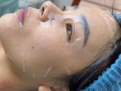 -安徽合肥韩美整形外科医院