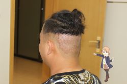 -大麦微针植发丨全国连锁